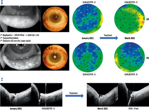 Follow-up of a patient, aged 66 years