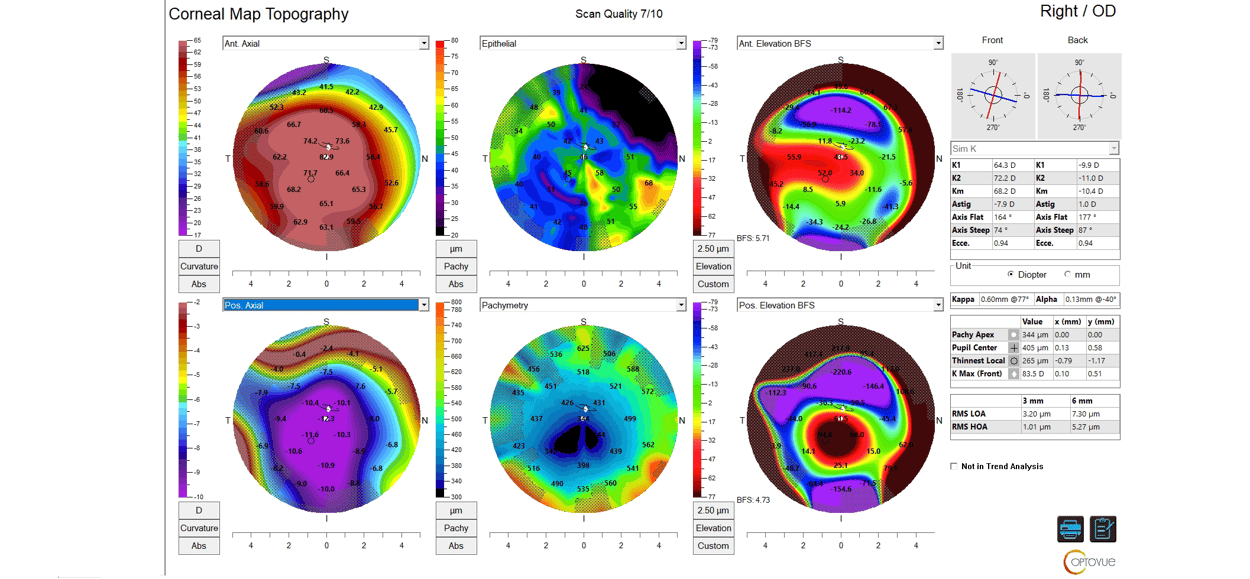 Case Study: When the Answer Isn’t Clear: The Power of Comprehensive Data in Clinical Decision-Making Image