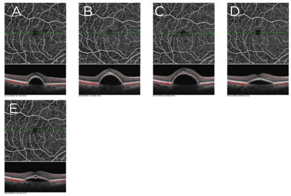 Figure 1-Barash