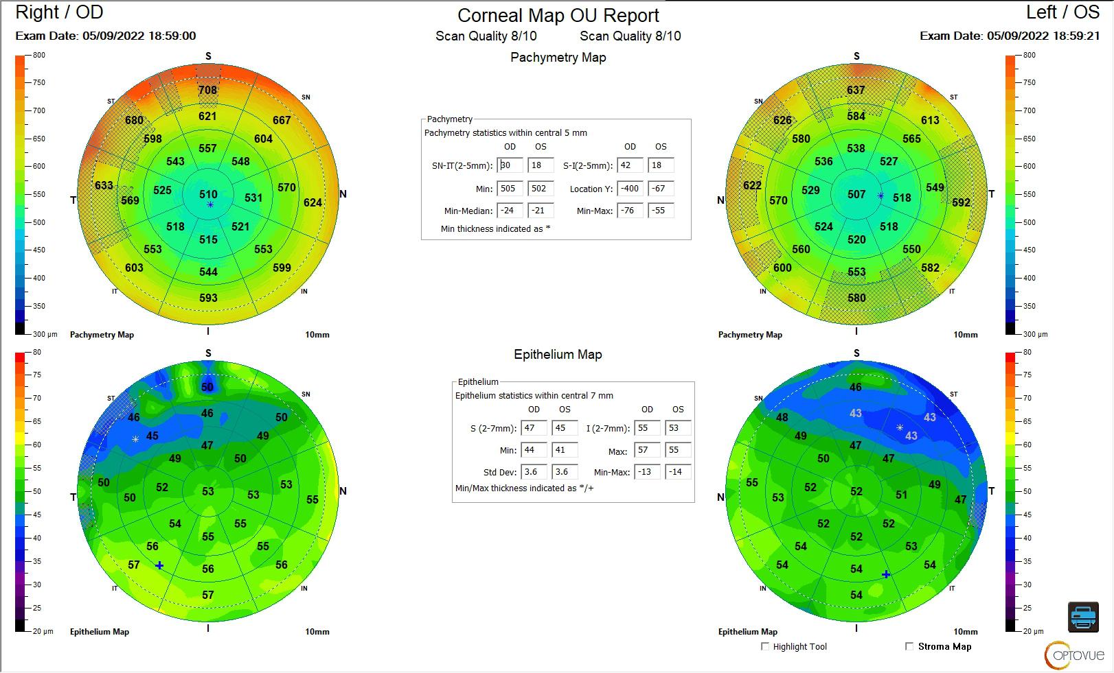 Figure 5 mapping avant