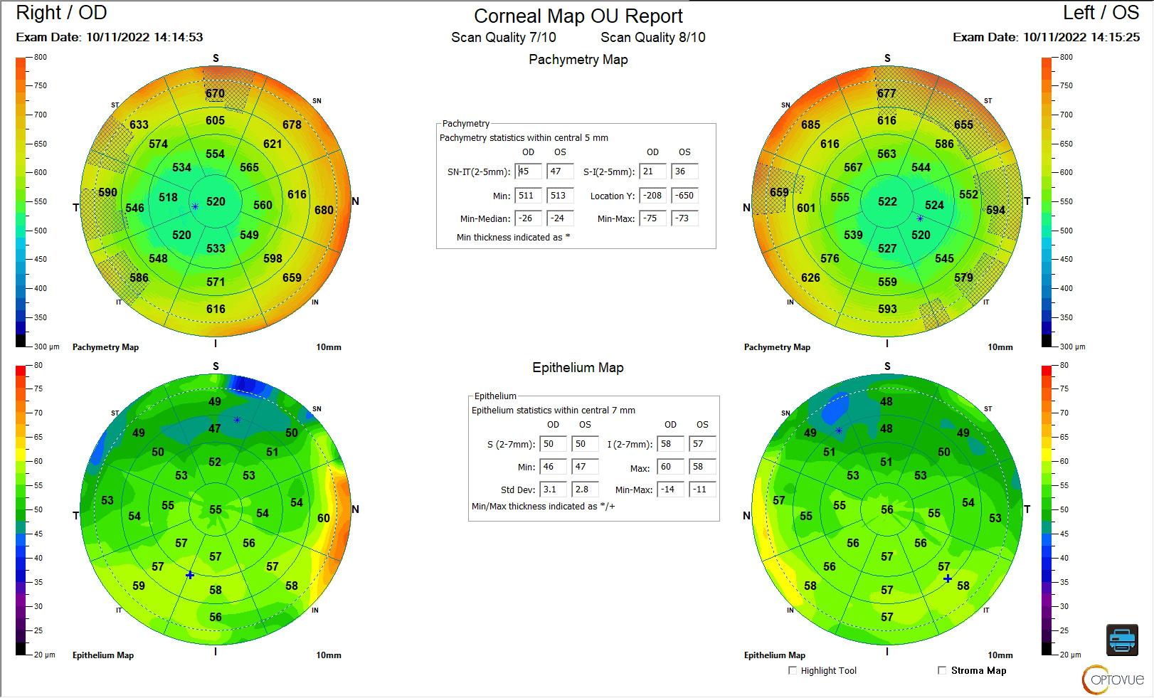 Figure 7 Mapping après