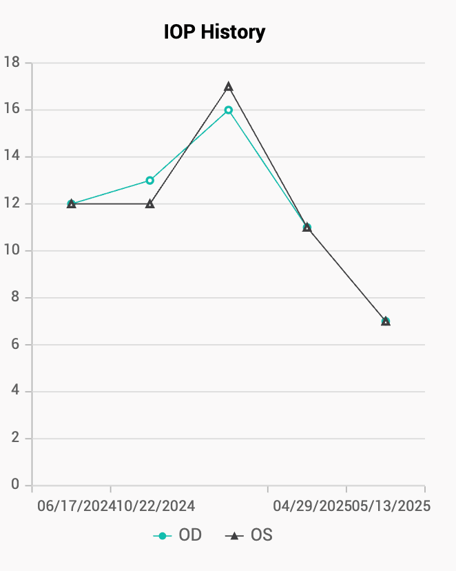 IOP Chart