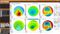 [OCT Comunicato stampa] Maggio 2025- Optovue Solix Topographia Image
