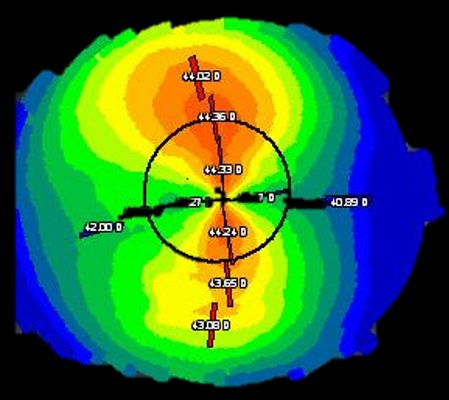 OD topography