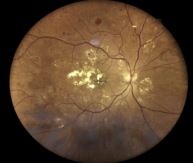 Case Study: Neo or No Neo? Image