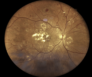 Case Study: Neo or No Neo? Image