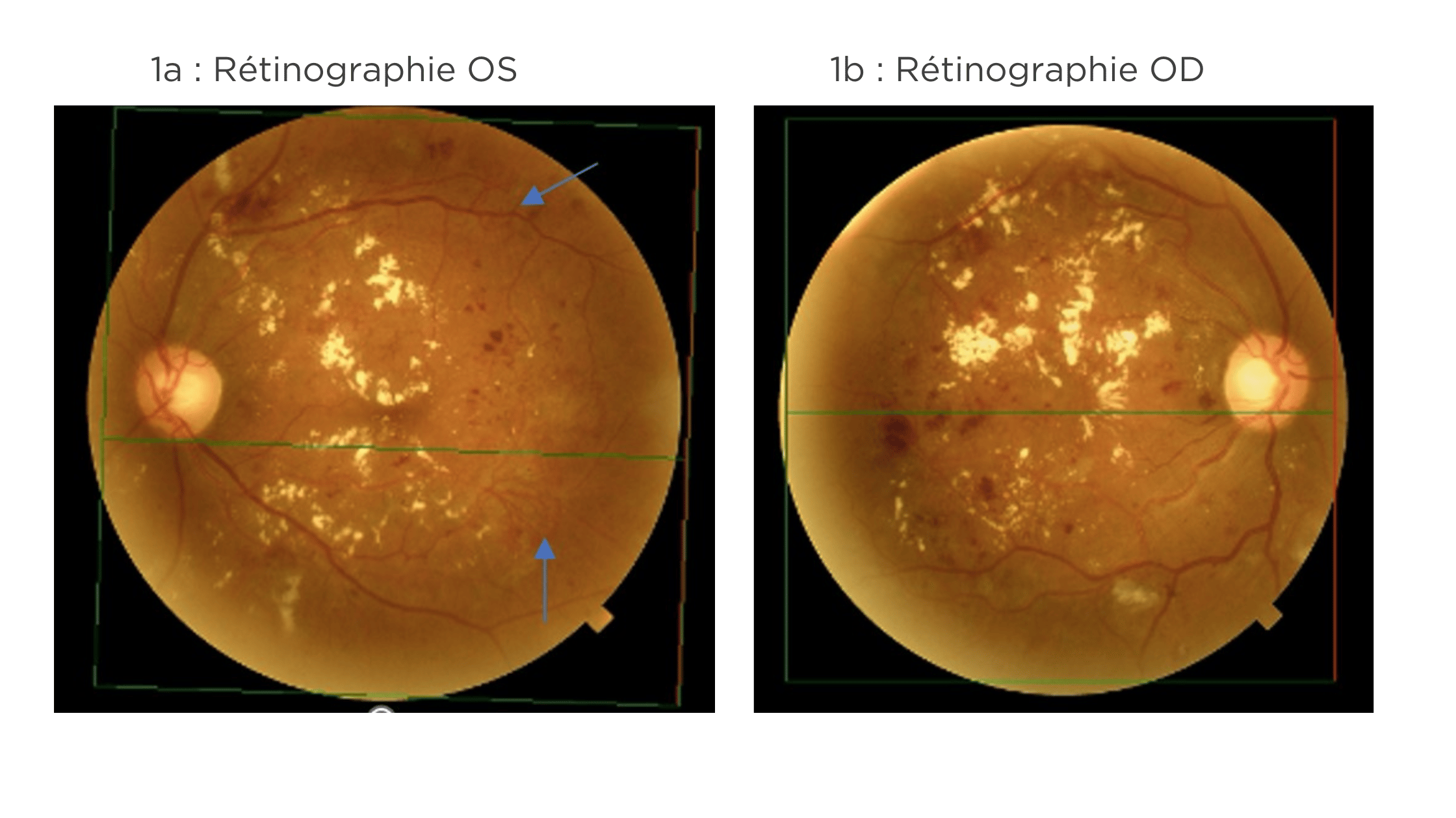 [ OCT ] Optovue Solix Protocole Rétine — free download