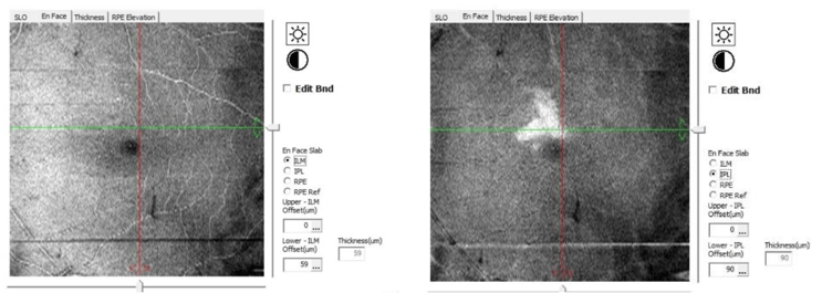 Shaffer Case - Figure 2