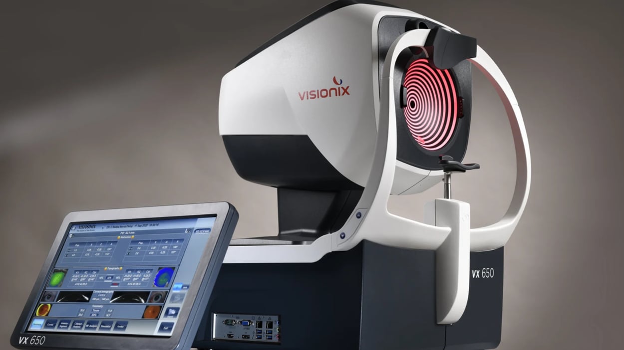 [Visionix VX650]: An innovative tool for screening ocular pathologies Image