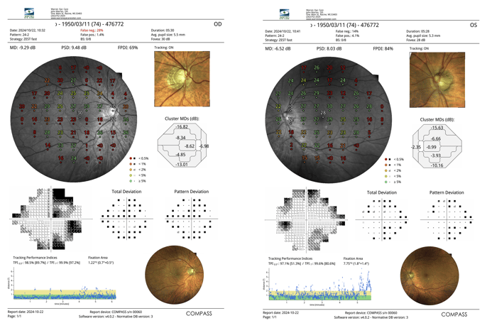 Visual Fields Report
