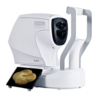 iCare_EIDON_with-screen-and-logo (2)