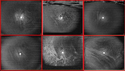 complementary visualization in a multimodal approach to dry eye by OCT.