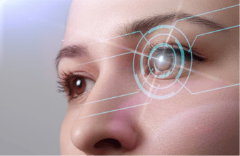 [OCT Observations] Screening for Refractive Surgery Image