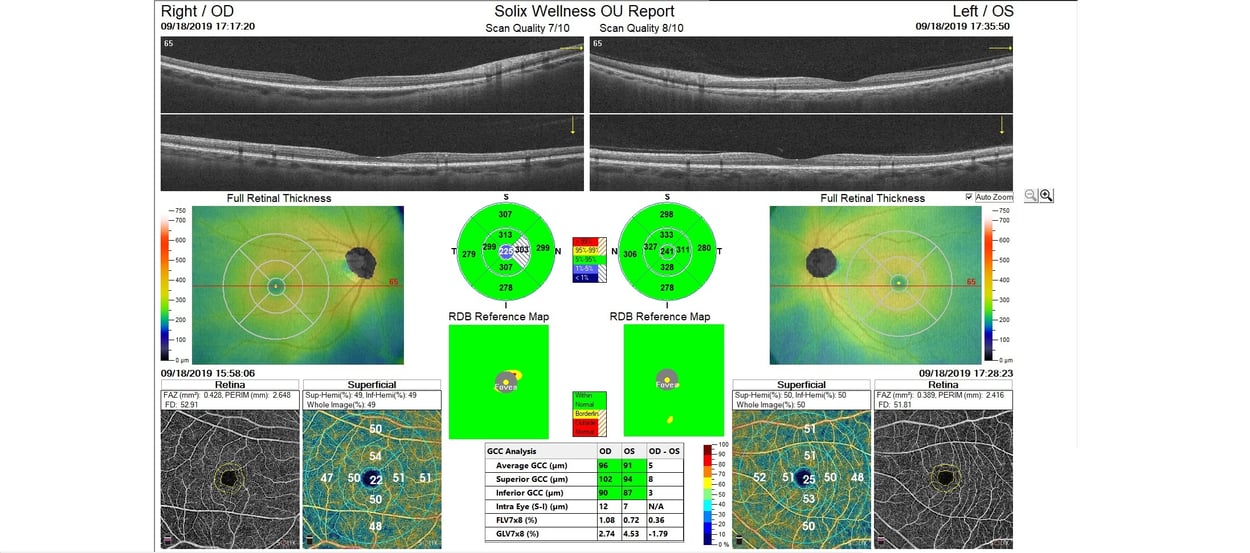 One Platform, More Patients: New OCT Streamlines Exams Image
